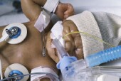 Death Rate for Extremely Premature Infants Largely Unchanged