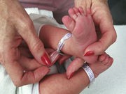Study: Extremely Premature Babies at Greater Risk for Autism