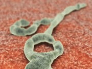 U.S. Ebola Survivors Suffered Lingering Effects