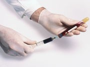 Blood Test Might Predict When Antibiotics Won't Help