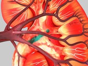 Even Slight Kidney Decline May Affect Heart