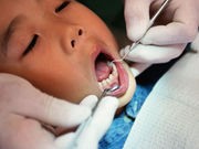 Keeping Your Child's Teeth Healthy