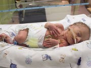 'Preemie' Babies May Face Long-Term Anesthesia Risks