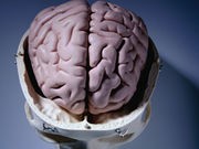 Right Brain Scan Could Aid in Stroke Recovery: Study
