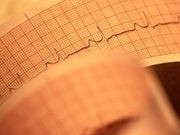 Wearable 'Defibrillator-in-a-Vest' May Help Some Heart Patients