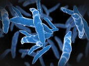 Screen High-Risk Adults for Tuberculosis, Experts Say