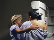 About Half of Women May Benefit From Mammograms at 40: Analysis