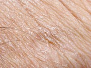 Novel E-Skin May Monitor Health, Vital Signs