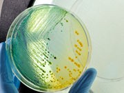 Cities May Have Distinct Microbial 'Citizens,' Too