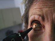 25 Million Americans Will Struggle With Vision Problems by 2050