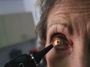 FDA Approves Eye Implant for Aging Boomers