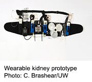 Coming Soon: A Wearable Artificial Kidney?