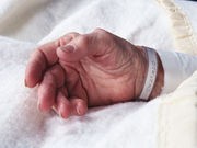 Fewer Advanced Alzheimer's Patients on Feeding Tubes