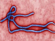 Ebola May Be Present in Semen for Year or More