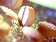 Older Drug May Help Type 1 Diabetics' Heart Health