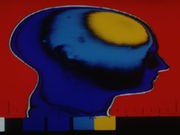 Doctors Try Brain-Training to Curb 'Phantom Limb Pain'