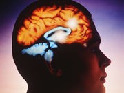 Brain Implant Lets 'Locked-In' ALS Patient Communicate