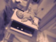 Premature Calcium Deposits May Trigger Premature Births: Study