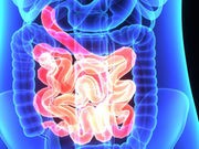 Drug Stelara May Ease Crohn's Disease