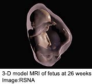 New Fetal Views in 3-D