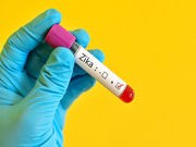 FDA Scientists Develop Mouse Model for Zika Research