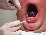Many Americans Skip the Dentist Due to Cost