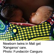 'Kangaroo Mother Care' May Improve Preemies' Lives Into Adulthood
