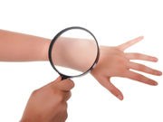 U.S. Melanoma Rate Is Rising, Study Finds