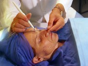 Plastic Surgeons Often Miss Patients' Mental Disorders